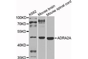 Western blot analysis of extracts of various cell lines, using ADRA2A antibody. (ADRA2A Antikörper)