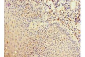 Immunohistochemistry of paraffin-embedded human tonsil tissue using ABIN7148407 at dilution of 1:100 (CD35 Antikörper  (AA 420-550))