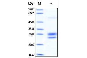SDS-PAGE (SDS) image for Interleukin 7 (IL7) (AA 26-177) (Active) protein (ABIN2181324)