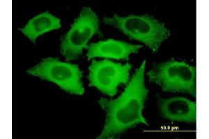 Immunofluorescence of monoclonal antibody to TIPIN on HeLa cell. (TIPIN Antikörper  (AA 1-301))