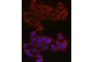 Immunofluorescence analysis of U-2 OS cells using EIF4E2 Rabbit pAb (ABIN6130366, ABIN6140086, ABIN6140087 and ABIN6220578) at dilution of 1:100 (40x lens). (EIF4E2 Antikörper  (AA 1-240))