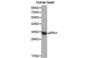 Western Blotting (WB) image for anti-Pyrophosphatase (Inorganic) 1 (PPA1) antibody (ABIN1874203) (Pyrophosphatase (Inorganic) 1 (PPA1) Antikörper)