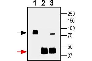 Immunoprecipitation of rat brain lysates using SV2A antibody1.