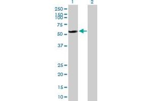 Western Blot analysis of RAD23B expression in transfected 293T cell line by RAD23B MaxPab polyclonal antibody. (RAD23B Antikörper  (AA 1-409))