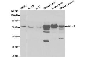 Western Blotting (WB) image for anti-Galactosamine (N-Acetyl)-6-Sulfate Sulfatase (GALNS) antibody (ABIN1876649) (GALNS Antikörper)