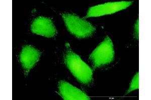 Immunofluorescence of purified MaxPab antibody to PTK2B on HeLa cell. (PTK2B Antikörper  (AA 1-1009))