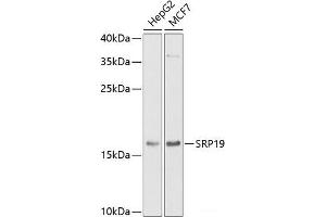Western blot analysis of extracts of various cell lines using SRP19 Polyclonal Antibody at dilution of 1:1000. (SRP19 Antikörper)