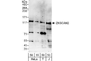 Western Blotting (WB) image for anti-Zinc Finger with KRAB and SCAN Domains 2 (ZKSCAN2) (AA 917-967) antibody (ABIN7453286)