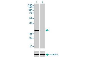 Western Blotting (WB) image for anti-Ketohexokinase (KHK) (AA 1-299) antibody (ABIN598769) (Ketohexokinase Antikörper  (AA 1-299))
