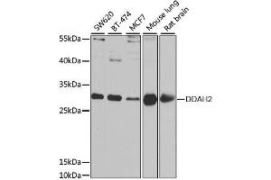 Western blot analysis of extracts of various cell lines, using DDAH2 antibody. (DDAH2 Antikörper  (AA 1-285))