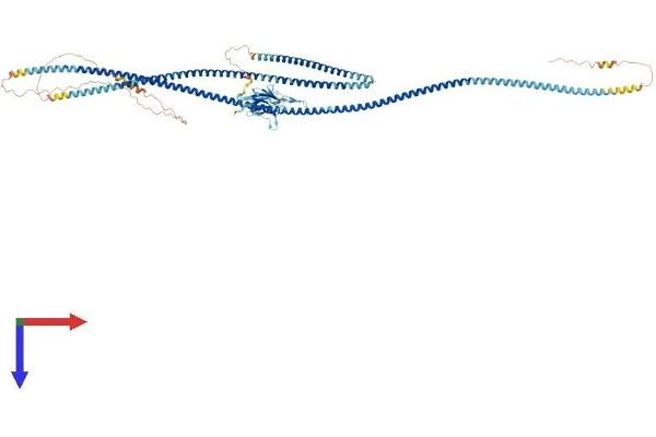 SLMAP Protein (AA 1-845) (His tag)
