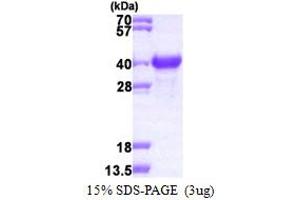 SDS-PAGE (SDS) image for Nascent Polypeptide Associated Complex alpha 1 (NACa1) (AA 1-215) protein (His tag) (ABIN667605)