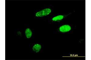 Immunofluorescence of monoclonal antibody to HIC1 on HeLa cell. (HIC1 Antikörper  (AA 396-453))