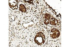 IHC analysis of CLPB using anti-CLPB antibody (ABIN7601732).