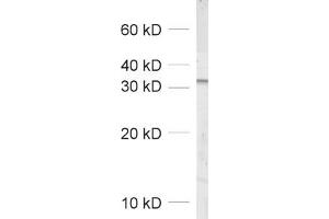 dilution: 1 : 1000, sample: crude synaptosomal fraction of rat brain (P2) (NAPG Antikörper  (AA 2-185))