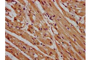 Immunohistochemistry (IHC) image for anti-Membrane Protein, Palmitoylated 3 (MAGUK P55 Subfamily Member 3) (MPP3) (AA 301-432) antibody (ABIN7158901)