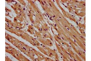 IHC image of ABIN7158901 diluted at 1:600 and staining in paraffin-embedded human heart tissue performed on a Leica BondTM system. (MPP3 Antikörper  (AA 301-432))