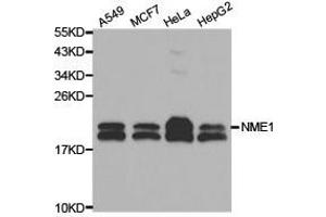 Western Blotting (WB) image for anti-Non-Metastatic Cells 1, Protein (NM23A) Expressed in (NME1) (C-Term) antibody (ABIN1873911) (NME1 Antikörper  (C-Term))