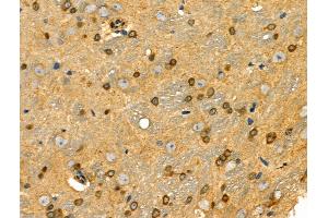 ABIN6258036 and ABIN6274198 at 1/100 staining Rat brain tissue by IHC-P.