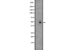 Western blot analysis of GPR83/GPR72 expression in Rat brain lysates in RIPA buffer ;developed using the ECL technique;,The lane on the left is treated with the antigen-specific peptide. (GPR83 Antikörper  (N-Term))