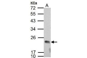 WB Image Sample (30 ug of whole cell lysate) A: NCI-H929 12% SDS PAGE antibody diluted at 1:2000
