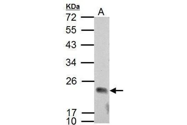 APOBEC3C antibody  (Center)