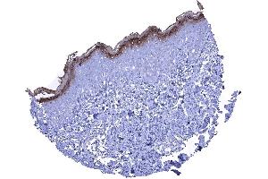 A strong KLK7 staining in the stratum granulosum and the keratinizing superficial layer of the skin (Kallikrein 7 Antikörper)