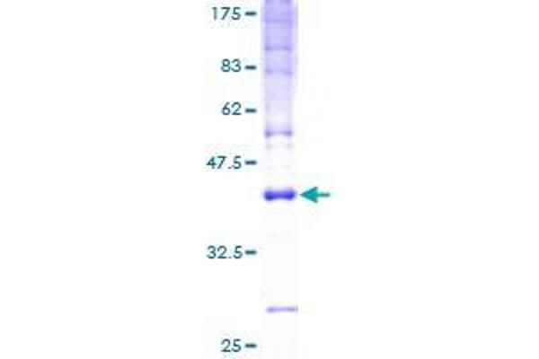 CMTM5 Protein (AA 1-156) (GST tag)