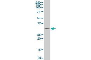 PDGFC polyclonal antibody (A01), Lot # 050926JC01 Western Blot analysis of PDGFC expression in 293 . (PDGFC Antikörper  (AA 236-345))