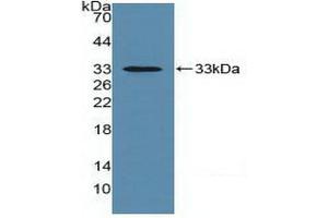 Detection of Recombinant MHCC, Human using Polyclonal Antibody to Major Histocompatibility Complex Class I C (MHCC)