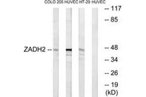 Western blot analysis of extracts from HuvEc/HT-29/COLO cells, using ZADH2 Antibody. (ZADH2 Antikörper  (AA 191-240))