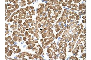 Immunohistochemistry (IHC) image for anti-Tropomyosin-2 (TPM2) (C-Term) antibody (ABIN2783288) (TPM2 Antikörper  (C-Term))