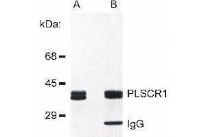Immunoprecipitation (IP) image for anti-phospholipid Scramblase 1 (PLSCR1) antibody (ABIN192390)
