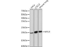Western blot analysis of extracts of various cell lines, using MYL9 Rabbit mAb (ABIN7268755) at 1:1000 dilution. (MYL9 Antikörper)