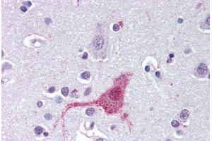 Anti-EDNRB antibody  ABIN1048558 IHC staining of human brain, cortex. (EDNRB Antikörper  (N-Term))