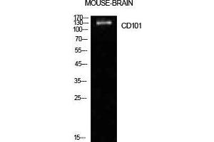 Western Blot (WB) analysis of Mouse Brain cells using CD101 Polyclonal Antibody. (CD101 Antikörper  (Internal Region))