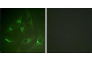 Immunofluorescence analysis of HeLa cells, using CSFR (Ab-561) Antibody. (CSF1R Antikörper  (AA 531-580))