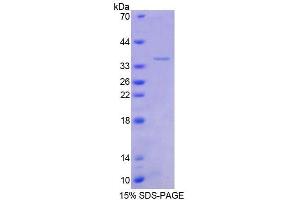SDS-PAGE analysis of Human TSC22 Protein.