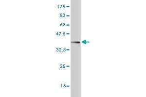 Western Blotting (WB) image for anti-A Kinase (PRKA) Anchor Protein 13 (AKAP13) (AA 1-110) antibody (ABIN524646)