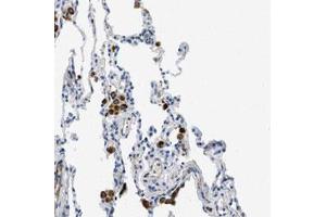 Immunohistochemical staining (Formalin-fixed paraffin-embedded sections) of human lung with XCR1 polyclonal antibody  shows strong cytoplasmic positivity in macrophages.