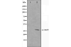 Western blot analysis on NIH-3T3 cell lysate using TIMP4 Antibody,The lane on the left is treated with the antigen-specific peptide. (TIMP4 Antikörper  (C-Term))