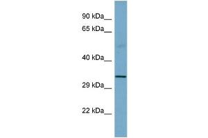 Host:  Rabbit  Target Name:  SGCB  Sample Type:  Fetal Small Intestine lysates  Antibody Dilution:  1. (SGCB Antikörper  (Middle Region))