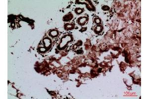 Immunohistochemistry (IHC) analysis of paraffin-embedded Human Skin, antibody was diluted at 1:100. (CEACAM1/5 Antikörper  (N-Term))