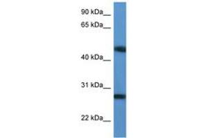 Image no. 1 for anti-TM2 Domain Containing 2 (TM2D2) (AA 97-146) antibody (ABIN6746862)