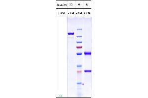 Product on SDS-PAGE under non-reducing (NR) and reducing (R) conditions. (Rekombinanter SLC39A6 Antikörper)