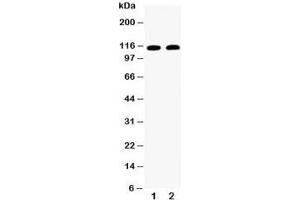 Western blot testing of Desmoglein 3 antibody and Lane 1:  A431;  2: CEM (Desmoglein 3 Antikörper  (AA 981-999))