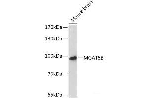 Western blot analysis of extracts of Mouse brain using MGAT5B Polyclonal Antibody at dilution of 1:3000. (MGAT5B Antikörper)