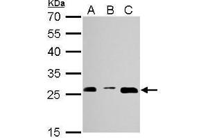 WB Image Proteasome 20S alpha 3 antibody detects PSMA3 protein by Western blot analysis.