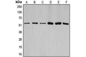 Western blot analysis of Cyclin A1/2 expression in HEK293T (A), NIH3T3 (B), rat brain (C), SW626 (D), SKOV3 (E), A2780 (F) whole cell lysates. (Cyclin-A1-2 Antikörper  (Center))