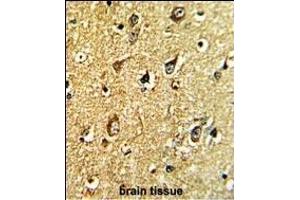 Formalin-fixed and paraffin-embedded human brain tissue with TH Antibody (C-term), which was peroxidase-conjugated to the secondary antibody, followed by DAB staining. (TH Antikörper  (C-Term))